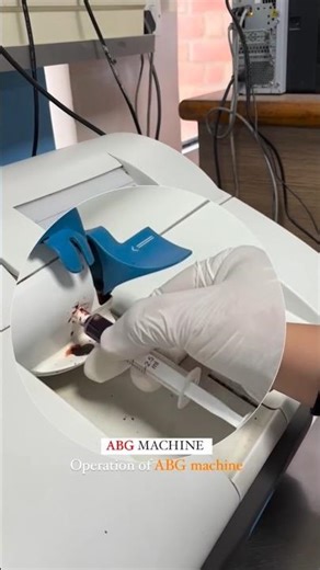 🩸💉 How to Operate ABG Machine Like a Pro!Nursing students must watch 👩‍⚕️👨‍⚕️🔥#ABG Made EASY 💯