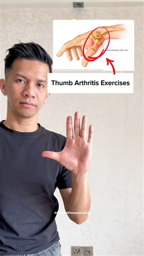 These simple thumb exercises help relieve pain and stiffness from thumb joint arthritis by gently mobilizing the joint and activating the surrounding muscles. Regular movement increases synovial fluid circulation, which nourishes the cartilage and reduces joint friction, making daily tasks like gripping and pinching more comfortable. Doing these exercises consistently can improve thumb strength, maintain joint mobility, and reduce swelling over time. They also help prevent further stiffness and 
