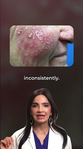 Eczema vs psoriasis... Did you know the difference? #dermatologist #skincare