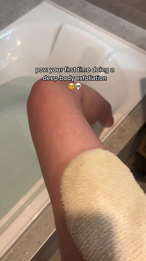 Doing a deep body exfoliation once a week is - especially important for those with naturally dry skin & prone to keratosis pilaris and strawberry legs (those pesky little bumps on our skin - particular on upper arms & legs). 🤭 Our exfoliating glove helps in this process; effectively buffing away dry skin and dead skin cells to stimulate new healthy cell growth. #fyp #bodyexfoliation #exfoliating #exfoliatingglove #smoothskin #keratosispilaris #strawberrylegstreatment #darkarmpits #ingrownhair #