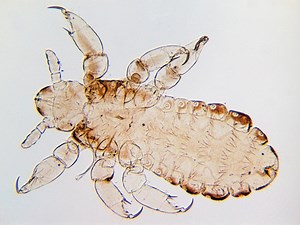 Super lice are a thing. Treating them can mean more than nit-picking