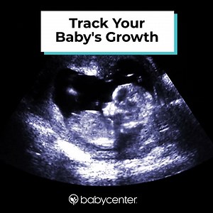 72 reactions | 擄Everything you need in one pregnancy app! Daily updates + Baby names finder + Contraction timer + Birth class + Community & More | BabyCenter | Facebook