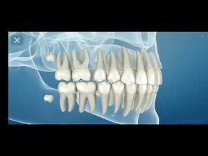 Eruption of permanent dentition, Eruption sequence of permanent tooth 3d animation