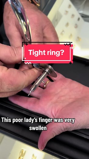 Quick and Painless Removal of Tight Rings - Ring Cutter for Swollen Fingers