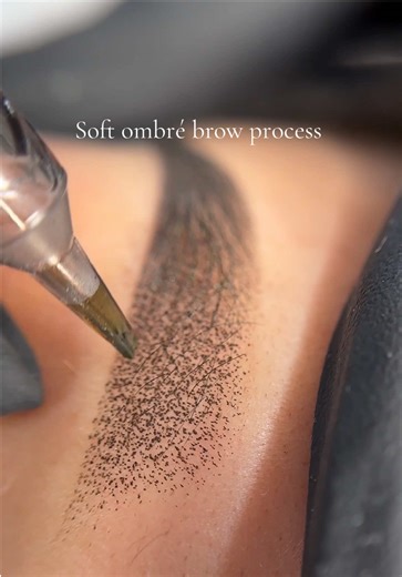 Ombrè brow technique creates a soft, powdered look. This technique uses a gentle machine to create gradient effect. Ombre brows give a filled in brow pencil effect once healed. - Duration: This procedure can last between 12 months to 3 years or longer. Longevity of the procedure depends on the skin type, lifestyle, and individual factors. Yearly touch-ups are recommended for color and shape maintenance. - Healing Process: Healing for powdered ombré and combination brows typically takes 2 weeks. 