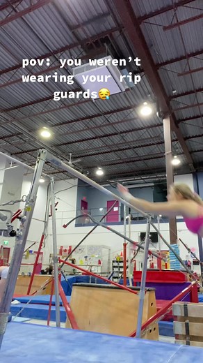 Gymnast Hand Rips: Why Rip Guards Are Essential