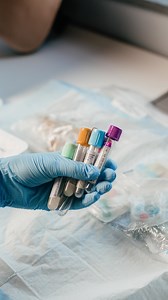 67K views · 787 reactions | Electrolytes Lab Values 離喝喙 SODIUM:...