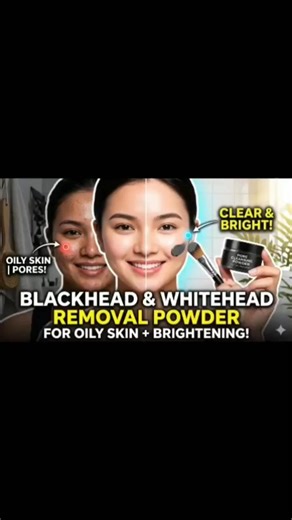 Permanent Blackhead Removel at Home with only 3 ingredients 💫#viral #shorts #shortsfeed