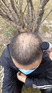 37K views · 482 reactions | Elevate your hair game with our transformative Hair Powder! ‍♀️✨ Get your hands on our Hair Powder today and let your hair do the talking! ✨ (link in bio)  Shop link in bio www.howdoibuythis.com #HairPowder #VolumeRevolution #HairGameStrong | tech_inventions | Facebook