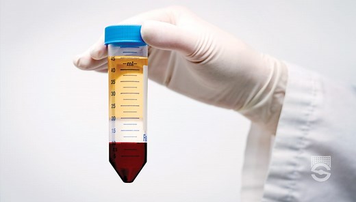 RosetteSep™ Immunodensity Cell Separation