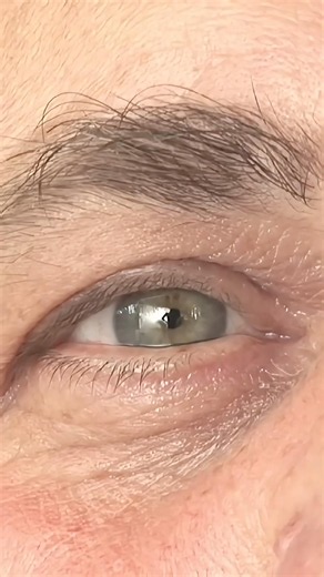 This Is How These Diseases Change Your Vision