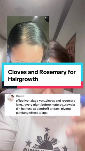 Cloves and Rosemary Natural Remedy for Hair Growth