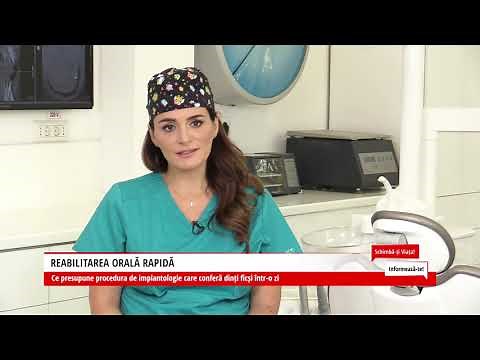 Proteza fixa cu 4 sau 6 implanturi dentare | Reabilitare orala totala - Dinti ficsi in 24 ore pret