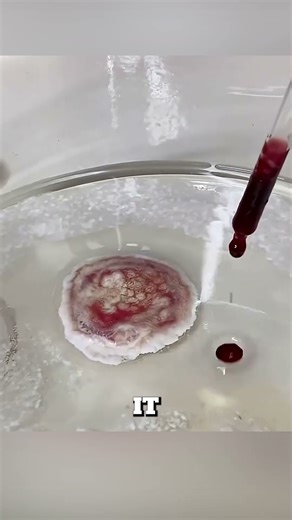 Why Hydrogen Peroxide Is Bad for Wounds 😳