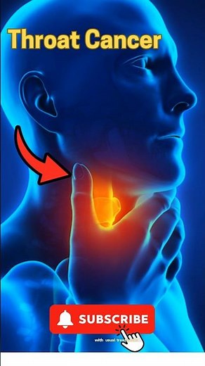 5 Key Symptoms of Throat Cancer | Recognize the Warning Signs