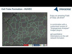Cell Tube Formation - HUVEC on Matrigel