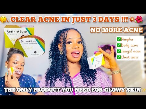 HOW TO USE RETIN-A SOAP 24K TO CLEAR ACNE| Get Rid of acne in 3 days + How To Achieve A Glowing Skin