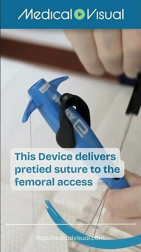 Mastering ProStyle Perclose Device