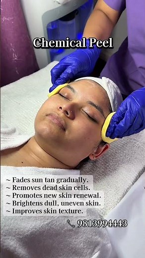 Sun Tan Removal By Chemical Peeling