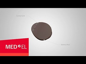 RONDO Hands-On: Introducing the RONDO—MED-EL