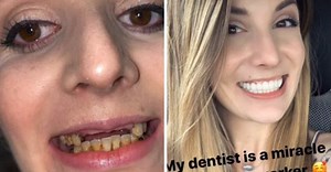 'My dentist is a miracle worker': A teeth restoration story that will make you respect dentists even more