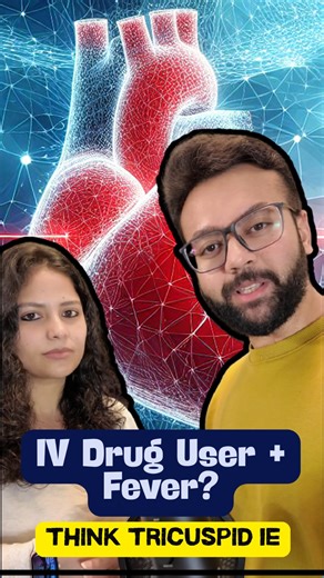 🚨 IV drug user fever hemoptysis? This isn’t pneumonia. Think deeper. 👀🫀 Fever, cough, pleuritic chest pain, hemoptysis, and a holosystolic murmur louder on inspiration = 🚩 right-sided infective endocarditis until proven otherwise. Most common culprit? Staphylococcus aureus. Why the lung symptoms? Septic pulmonary emboli → pulmonary infarcts or abscesses. 📌 Workup that actually matters: • Start with TTE for suspected infective endocarditis • High suspicion negative TTE? → TEE is the move • D