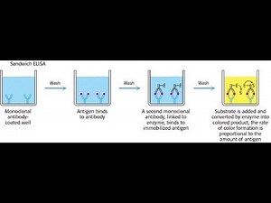 Sandwich ELISA Test (Enzyme Linked Immunosorbent Assay) ; Definition, Steps, Procedure, Application