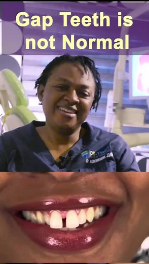 Understanding Gap Teeth: Causes and Treatment Options