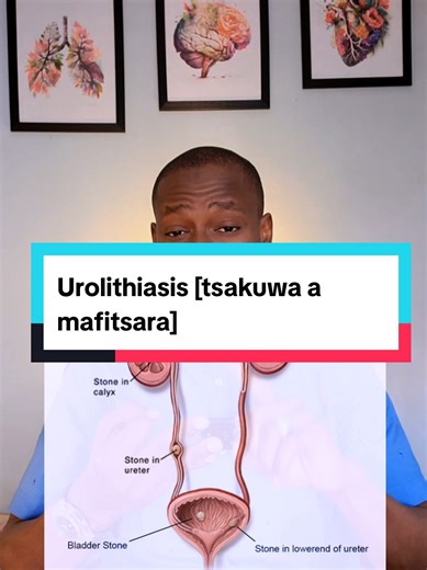 Understanding Urolithiasis in Hausa Language