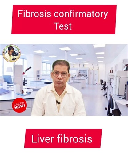 fibrosis confirmatory Test | liver Fibrosis | #fib4 #fibrosis