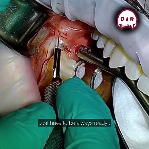 Cyst Popping in the Mouth