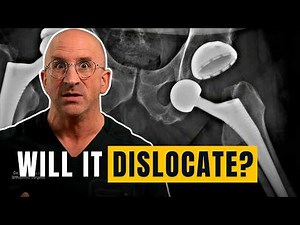 Will Your New Hip Dislocate? A Surgeon's Honest Answer