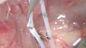 Taking the Next Step: a Neural Coaptation Orthotopic Hind Limb Transplant Model to Maximize Functional Recovery in Rat