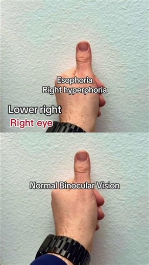 Image jump test with your thumb