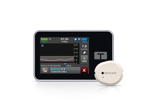 Tandem t:slim X2 Insulin Pump Now Compatible with Dexcom G7 CGM in Canada