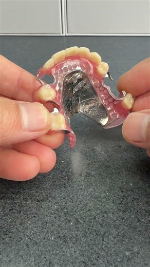 MISSING TEETH HERE AND THERE? 😱 This is the perfect fix!#dentist #smiledesigndental #PartialDenture