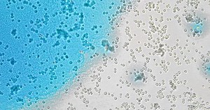 Hydrogen production (H2) Hydrogen bacteria under the microscope, enzymatic production of hydrogen from organic matter. Hydrogen as a renewable energy source