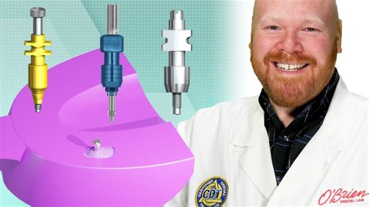 How to Take an Open Tray Implant Impression | Andrea Porter