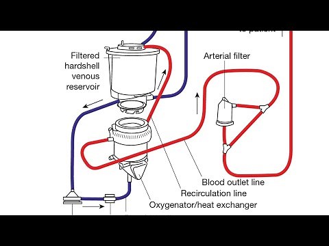 Cardio Pulmonary Bypass Machine | CPB Machine | Heart Lung Machine