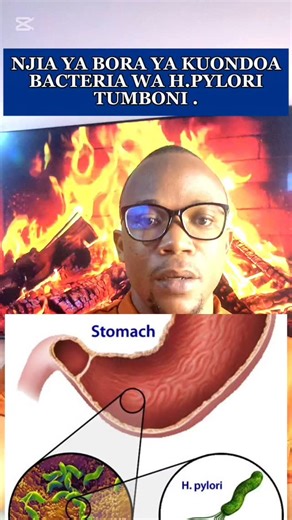 NAMNA SAHIHI YA KUONDOA BACTERA HAYARI WA H.PYLORI TUMBONI USHAURI NA TIBA KAMILI 255744964195 OFFICE LOCATION :MLIMANI CITY DAR ES SALAAAM #hpylori #tanzania #usa #healthyeating #healthfood | 𝐊𝐢𝐳𝐚𝐦𝐞𝐝𝐢𝐜𝐬
