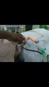 9.2K views · 257 reactions | Intraoperative Bronchospasm: Just two puff of Sulbutamol inhaler and then ventilate. You can resolve the bronchospasm just within a minute | Khalid's Clinical Anaesthesia | Facebook