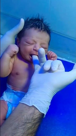 Neonatal Suck Reflex Check | Newborn Neurological Assessment