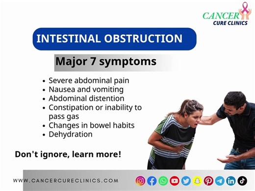 Intestinal Obstruction: A Serious Blockage in the Digestive Tract That Needs Immediate Attention for
