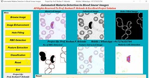 Automated Malaria Detection In Blood Smear Images Using Image Processing || IEEE Based Projects || Final Year Projects