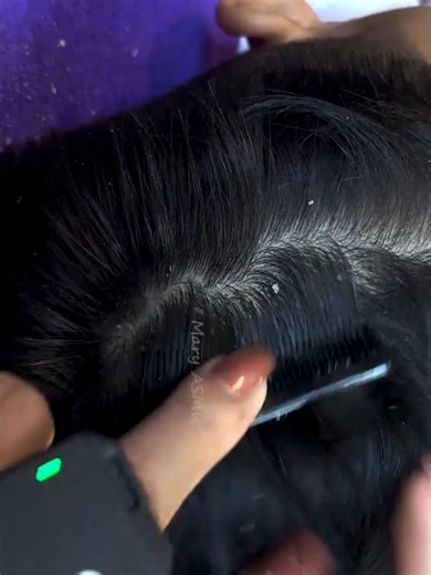 Effective Dandruff Removal Tips for Dry Scalp