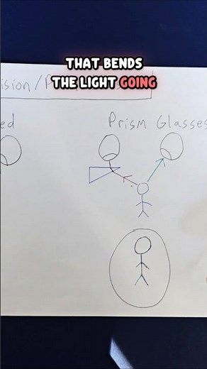 Double Vision and Prism Glasses