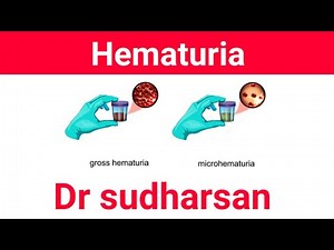 Approach To Hematuria - Types & Management- Dr Sudharsan