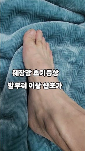 췌장암 초기증상 발부터 이상 신호가 ᆢ 발바닥통증 발저림 발부종 피부색변화 각질 가려움 건강최고다 팔도강산낚시 식객 동물농장 전국노래자랑 요요미