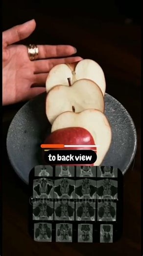 CBCT basic understanding | Axial Sagittal & Coronal planes of a CBCT scan