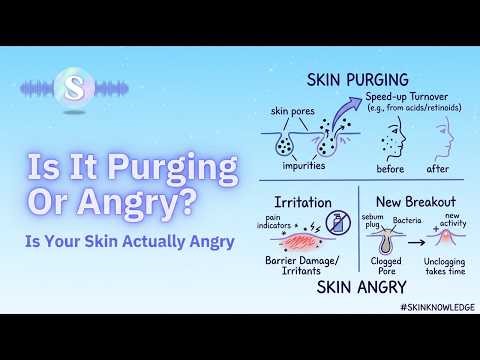 Is It Purging or Is Your Skin Actually Angry?